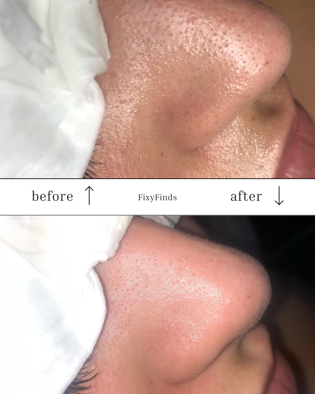 Smart Pore Vacuum