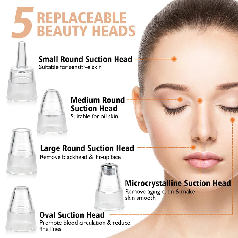 Smart Pore Vacuum – Blackhead Remover with 5 Heads & 3 Suction Modes